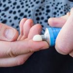 in cat timp se retrag hemoroizii externi forum